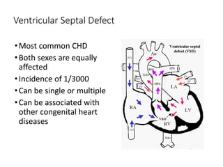 Ventricular Septal Defect
•Most common CHD
•Both sexes are equally
affected
•Incidence of 1/3000
•Can be single or multiple
•Can be associated with
other congenital heart
diseases
 