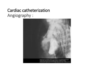 Cardiac catheterization
Angiography :
 