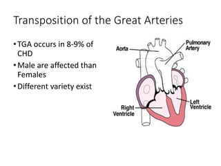 Transposition of the Great Arteries
•TGA occurs in 8-9% of
CHD
•Male are affected than
Females
•Different variety exist
 