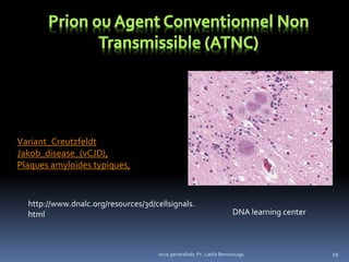 29
http://www.dnalc.org/resources/3d/cellsignals.
html DNA learning center
virus généralités: Pr. Latifa Berrezouga
Variant_Creutzfeldt
Jakob_disease_(vCJD),
Plaques amyloïdes typiques,
 