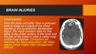 Accelaration Injries I LOVE NEUROSURGERY INITIATIVE: Cranio-cerebral Injuries part 1 | PPTX