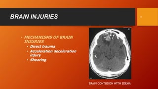 1cranio-cerebralinjuries1-211019105122 (1).pdf