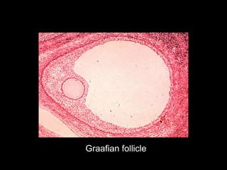 Graafian follicle 
 