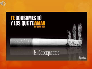 El tabaquismo
 