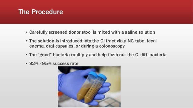 solution failure kidney for Microbiota Transplantation Fecal solution failure kidney for Microbiota Transplantation Fecal