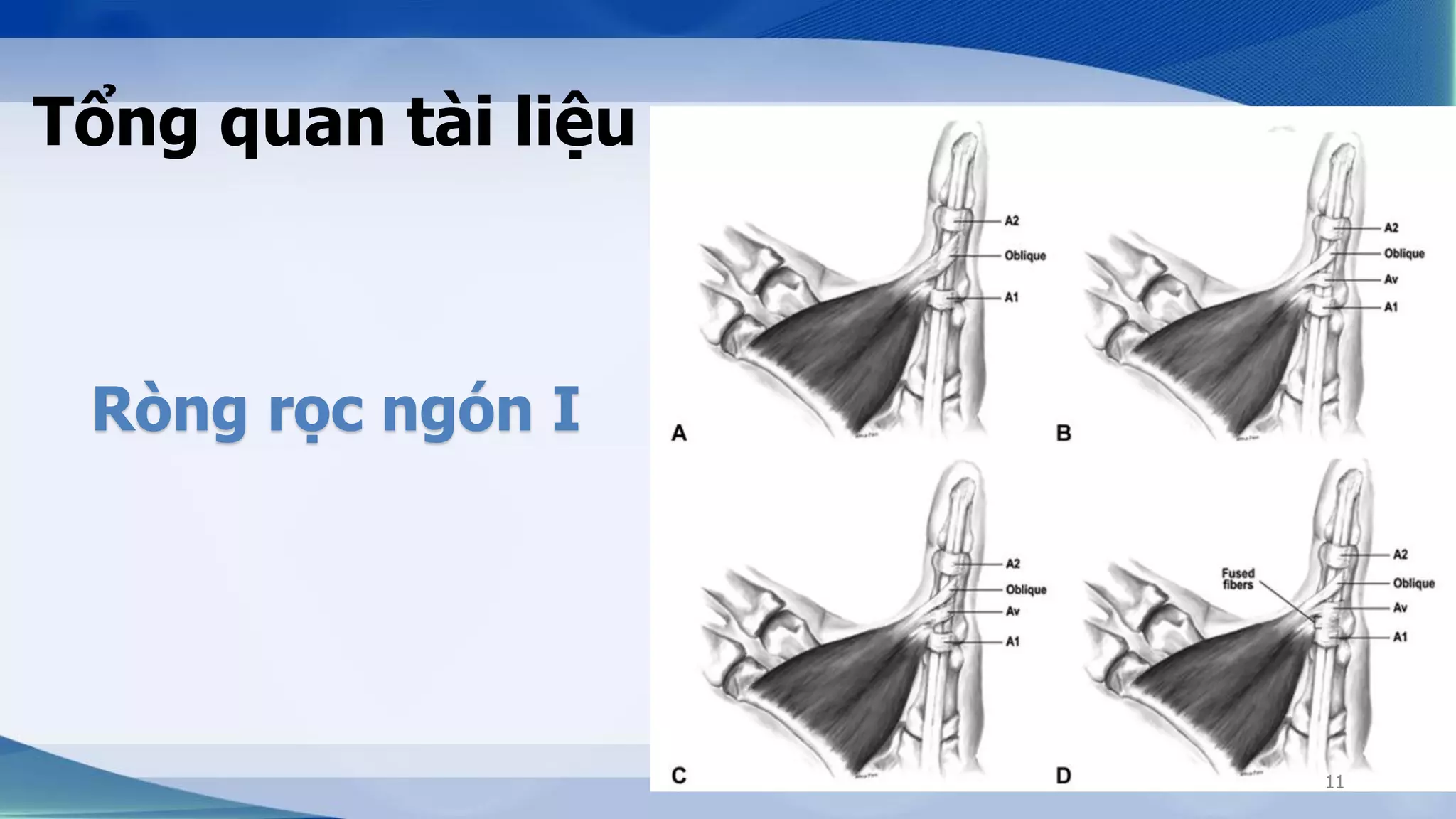 NGHIÊN CỨU GIẢI PHẪU ỨNG DỤNG CỦA CÁC RÒNG RỌC NGÓN TAY | PDF