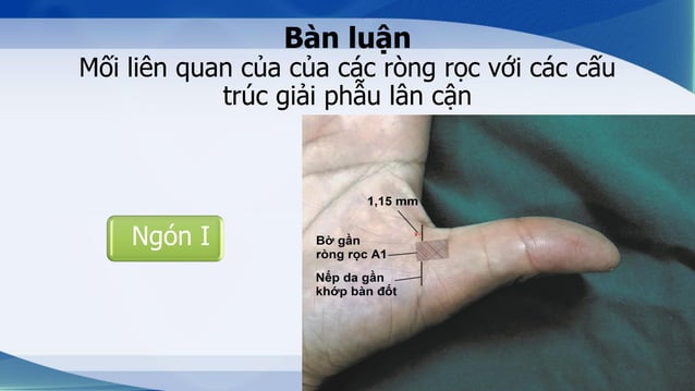 NGHIÊN CỨU GIẢI PHẪU ỨNG DỤNG CỦA CÁC RÒNG RỌC NGÓN TAY | PDF