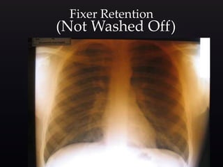 (Not Washed Off)
Fixer Retention
 