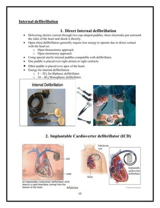 Internal defibrillation









1. Direct Internal defibrillation
Delivering electric current through two cup-shaped paddles, these electrodes put surround
the sides of the heart and shock it directly.
Open-chest defibrillators generally require less energy to operate due to direct contact
with the heart as:
o Open thoracotomy approach.
o Open sternotomy approach.
Using special sterile internal paddles compatible with defibrillator.
One paddle is placed over right atrium or right ventricle.
Other paddle is placed over apex of the heart.
Energy for internal defibrillation
o 5 – 20 j for Biphasic defibrillator.
o 10 – 40 j Monophasic defibrillator.

2. Implantable Cardioverter defibrillator (ICD)

12

 