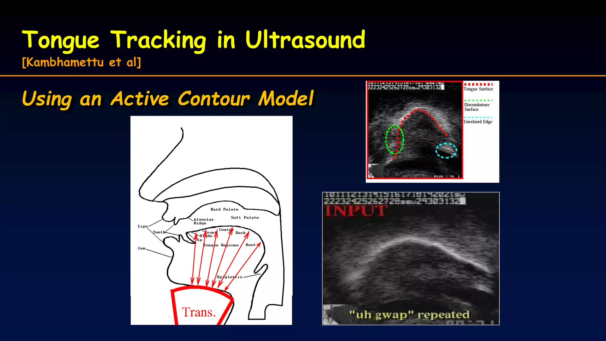 Tongue Tracking in Ultrasound
[Kambhamettu et al]
Using an Active Contour Model
 