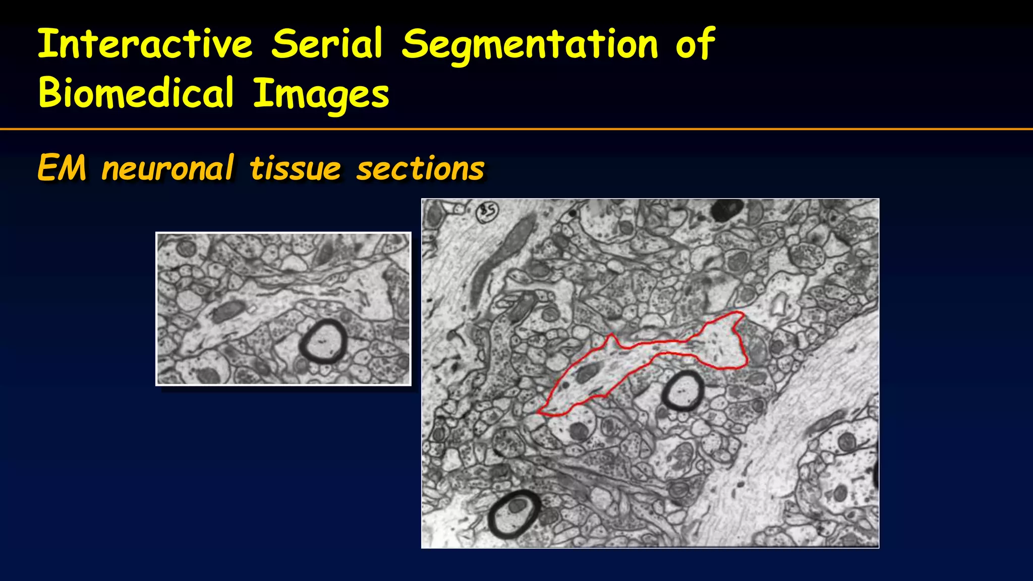 Interactive Serial Segmentation of
Biomedical Images
EM neuronal tissue sections
 