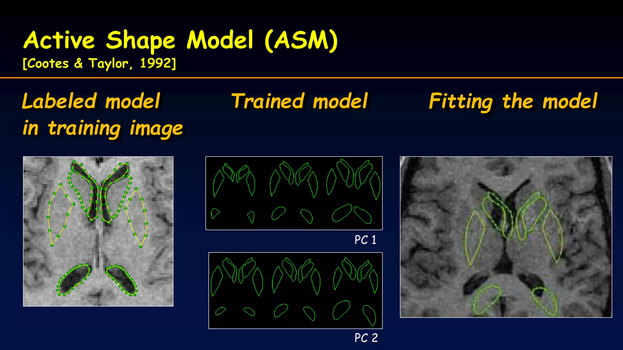 Active Shape Model (ASM)
[Cootes & Taylor, 1992]
Labeled model Trained model Fitting the model
in training image
PC 1
PC 2
 