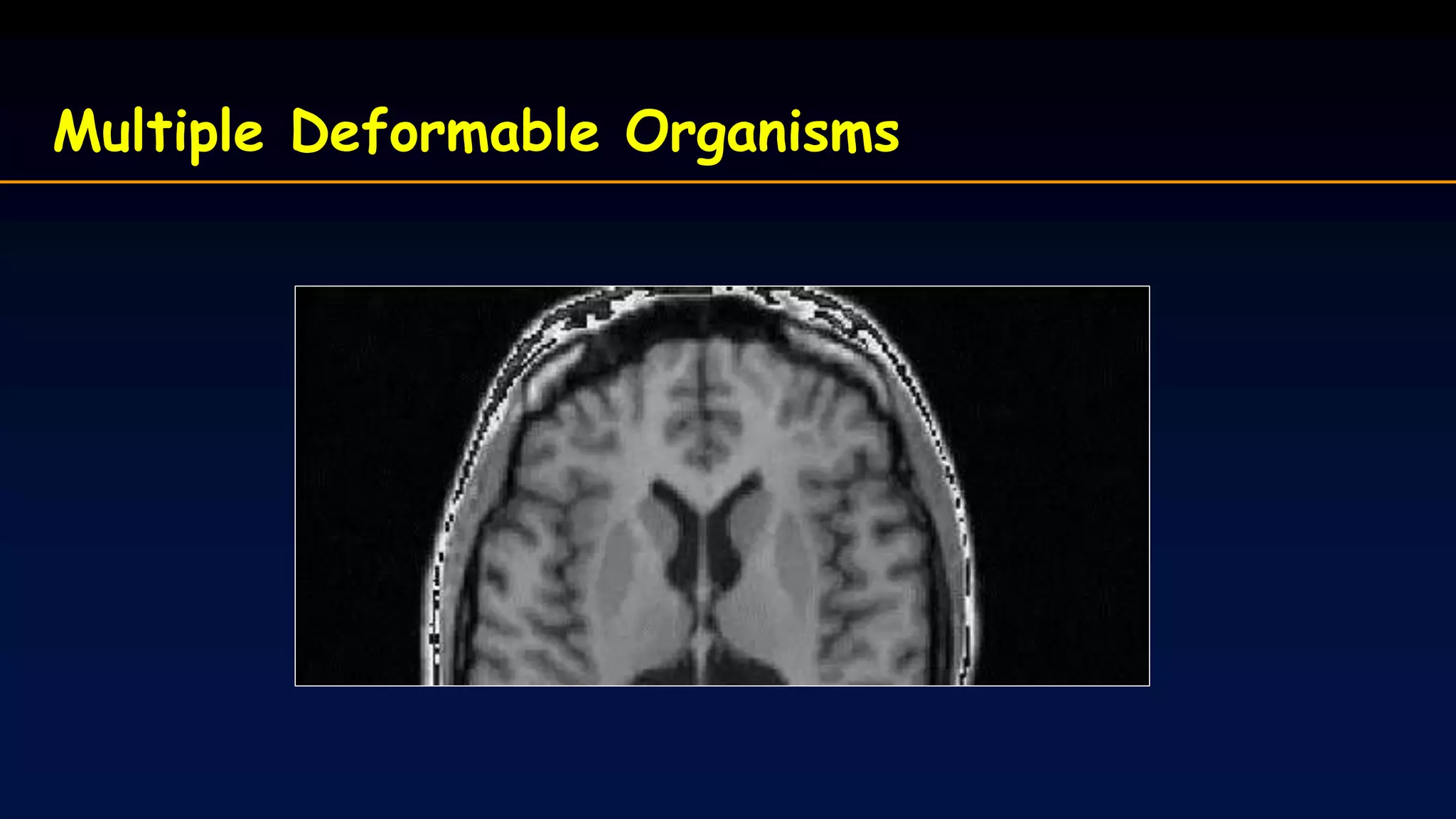 Multiple Deformable Organisms
 