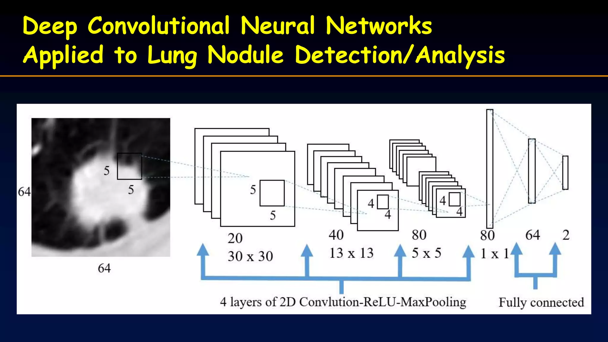 Deep Convolutional Neural Networks
Applied to Lung Nodule Detection/Analysis
 