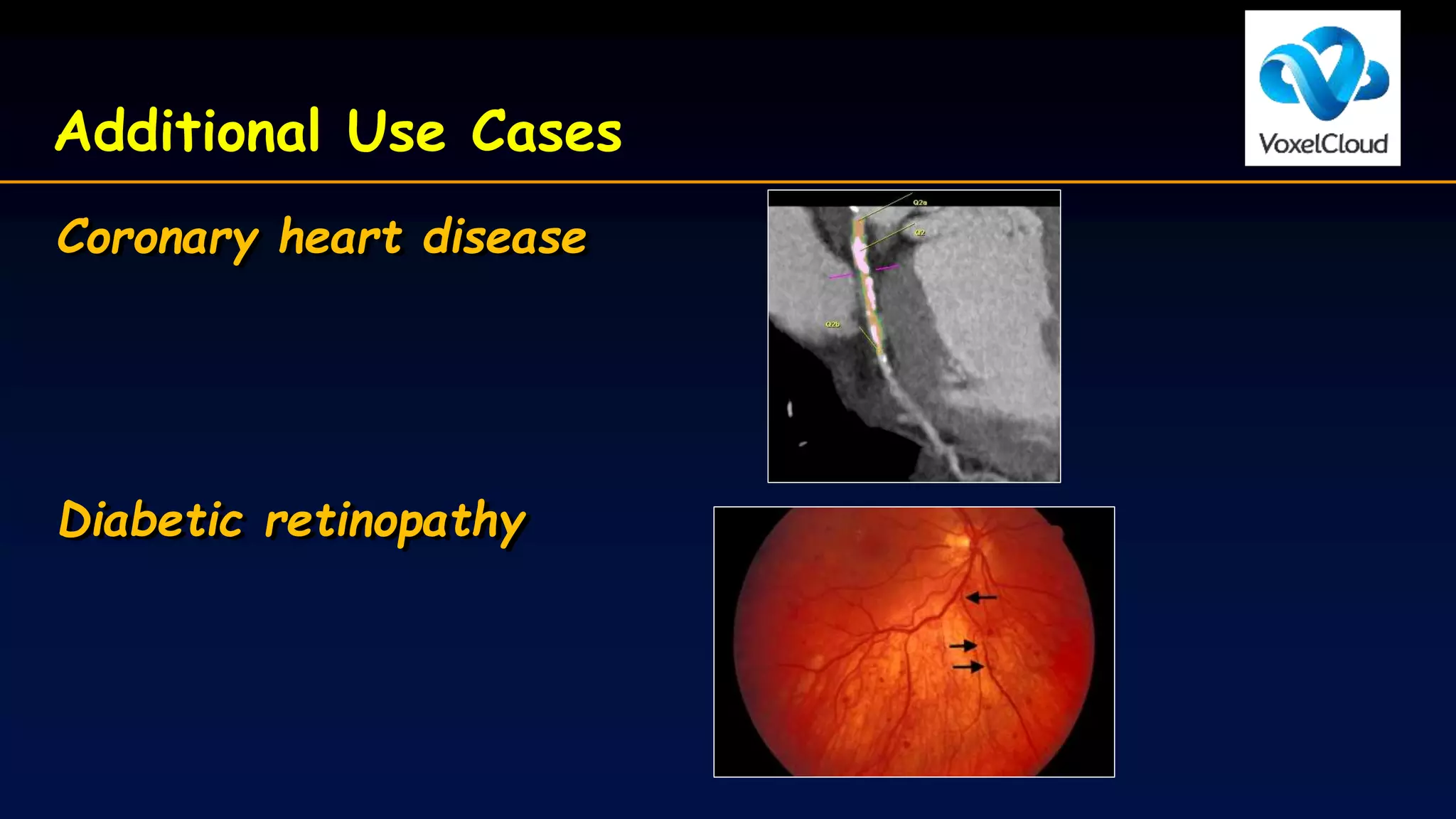 Additional Use Cases
Coronary heart disease
Diabetic retinopathy
 