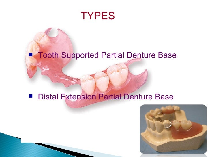 denture base considerations