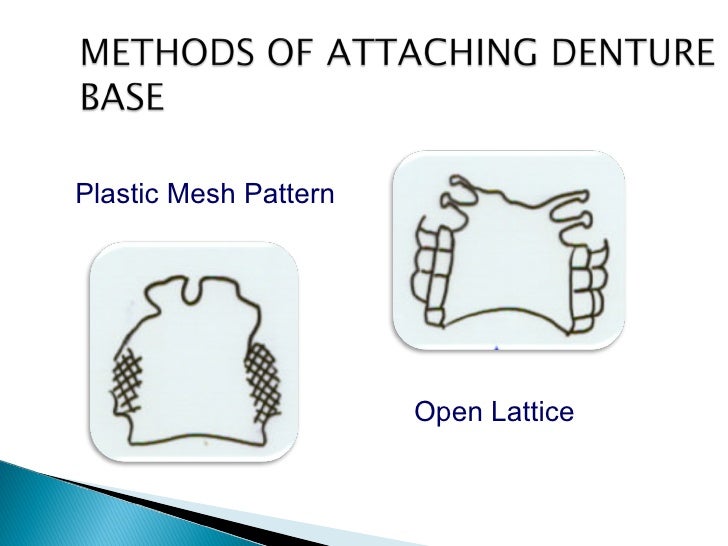 denture base considerations