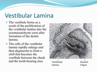 Vestibular Lamina
 The vestibule forms as a
result of the proliferation of
the vestibular lamina into the
ectomesenchyme soon after
formation of the dental
lamina.
 The cells of the vestibular
lamina rapidly enlarge and
then degenerate to form a
cleft that becomes the
vestibule between the cheek
and the tooth-bearing area. Vestibular
lamina
Enamel
Organ
 