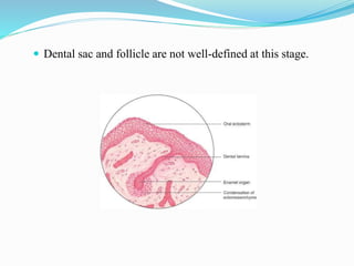  Dental sac and follicle are not well-defined at this stage.
 