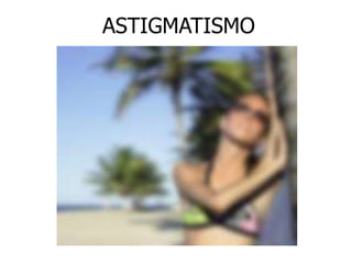 ASTIGMATISMO 
 