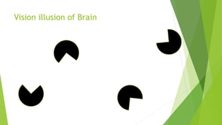 Vision illusion of Brain
 
