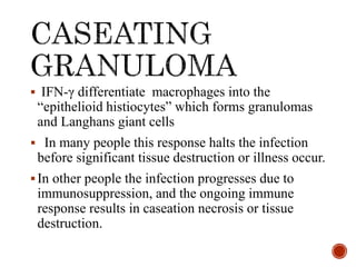 Caseating Definition Pathophysiology of Tuberculosis and it's Complications | PPTX