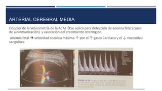 ARTERIAL CEREBRAL MEDIA
 