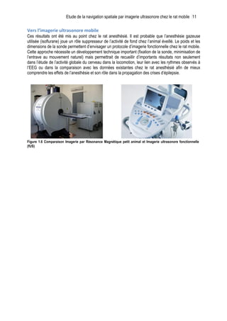 Etude de la navigation spatiale par imagerie ultrasonore chez le rat mobile 11
Vers	
  l’imagerie	
  ultrasonore	
  mobile	
  
Ces résultats ont été mis au point chez le rat anesthésié. Il est probable que l’anesthésie gazeuse
utilisée (isoflurane) joue un rôle suppresseur de l’activité de fond chez l’animal éveillé. Le poids et les
dimensions de la sonde permettent d’envisager un protocole d’imagerie fonctionnelle chez le rat mobile.
Cette approche nécessite un développement technique important (fixation de la sonde, minimisation de
l’entrave au mouvement naturel) mais permettrait de recueillir d’importants résultats non seulement
dans l’étude de l’activité globale du cerveau dans la locomotion, leur lien avec les rythmes observés à
l’EEG ou dans la comparaison avec les données existantes chez le rat anesthésié afin de mieux
comprendre les effets de l’anesthésie et son rôle dans la propagation des crises d’épilepsie.
Figure 1.6 Comparaison Imagerie par Résonance Magnétique petit animal et Imagerie ultrasonore fonctionnelle
(fUS)
 