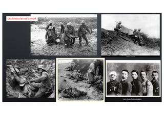 Les blessures et la mort
Les gueules cassées
 