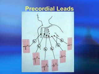 Precordial Leads 