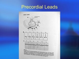 Precordial Leads 
