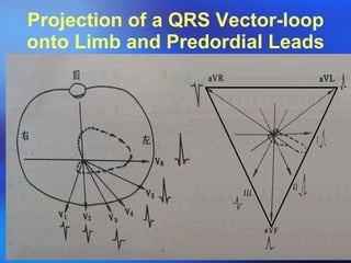 Projection of a QRS Vector-loop onto Limb and Predordial Leads 