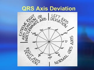 QRS Axis Deviation 