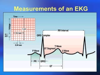 Measurements of an EKG 