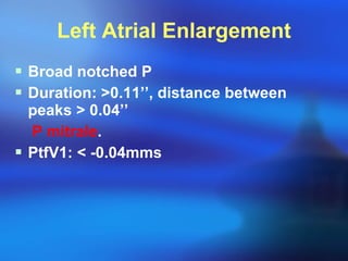 Left Atrial Enlargement Broad notched P Duration:  > 0.11’’, distance between peaks  >  0.04’’ P mitrale . PtfV1:  <  -0.04mms 