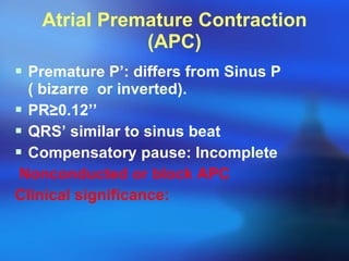 Atrial Premature Contraction (APC) Premature P’: differs from Sinus P ( bizarre  or inverted). PR ≥ 0.12’’ QRS’ similar to sinus beat Compensatory pause: Incomplete Nonconducted or block APC Clinical significance: 