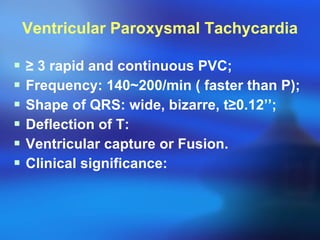Ventricular Paroxysmal Tachycardia ≥   3 rapid and continuous PVC; Frequency: 140~200/min ( faster than P); Shape of QRS: wide, bizarre, t ≥ 0.12’’; Deflection of T: Ventricular capture or Fusion. Clinical significance:  
