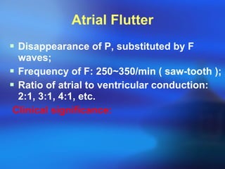 Atrial Flutter Disappearance of P,  substituted by F waves; Frequency of F: 250~350/min ( saw-tooth ); Ratio of atrial to ventricular conduction: 2:1, 3:1, 4:1, etc. Clinical significance:   