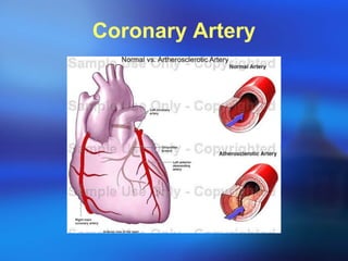 Coronary Artery 