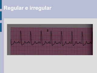 Regular e irregular
 