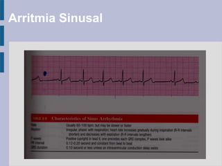 Arritmia Sinusal
 