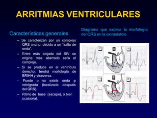 ARRITMIAS VENTRICULARES
Características generales
– Se caracterizan por un complejo
QRS ancho, debido a un “salto de
onda”.
– Entre
origine
más alejada del SIV se
más aberrado será el
complejo.
– Si se produce en el ventrículo
derecho, tendrá morfología de
BRIHH y viceversa.
no existir onda p
(localizada después
– Puede o
retrógrada
del QRS).
– Ritmo de base (escape), o bien
ocasional.
Diagrama que explica la morfología
del QRS en la extrasístole
 