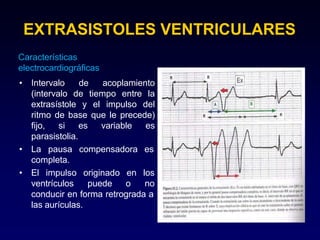 EXTRASISTOLES VENTRICULARES
Características
electrocardiográficas
• Intervalo de acoplamiento
(intervalo de tiempo entre la
extrasístole y el impulso del
ritmo de base que le precede)
fijo, si es variable es
parasistolia.
• La pausa compensadora es
completa.
• El impulso
ventrículos
originado en los
puede o no
conducir en forma retrograda a
las aurículas.
 
