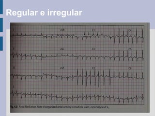 Regular e irregular
 