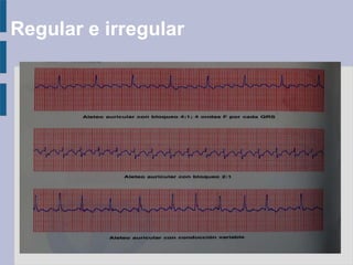 Regular e irregular
 