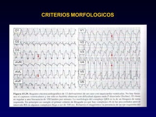 CRITERIOS MORFOLOGICOS
 