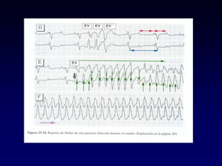 1 Electrocardiografía básica 2021.pptx