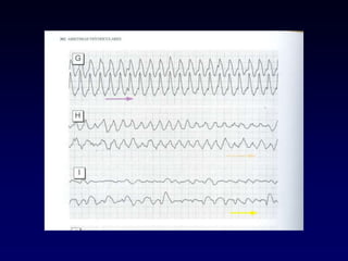 1 Electrocardiografía básica 2021.pptx