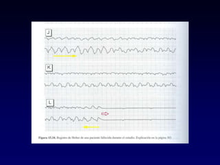 1 Electrocardiografía básica 2021.pptx