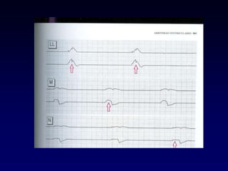 1 Electrocardiografía básica 2021.pptx